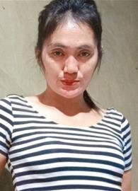 alene