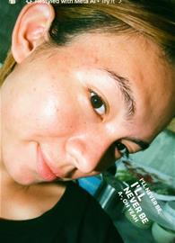 retana