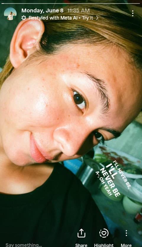 retana