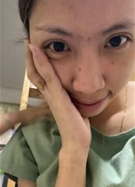 ekaaxx