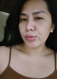 erms