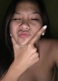 Mitchella
