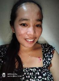 Anabell