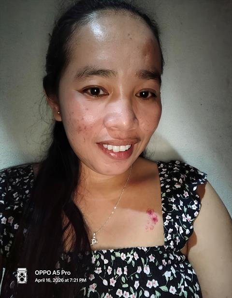 Anabell