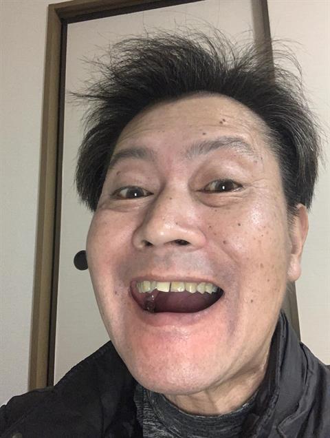 Yamachan