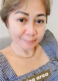 herlyn