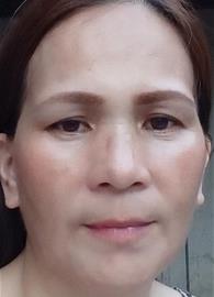 Rhodorap