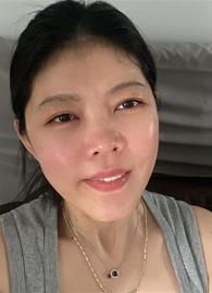 Lin9