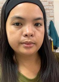 emrel