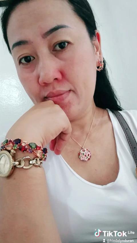 malyn duran