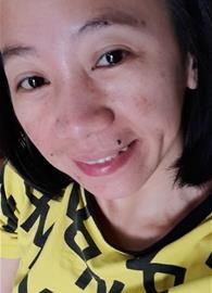 vnus