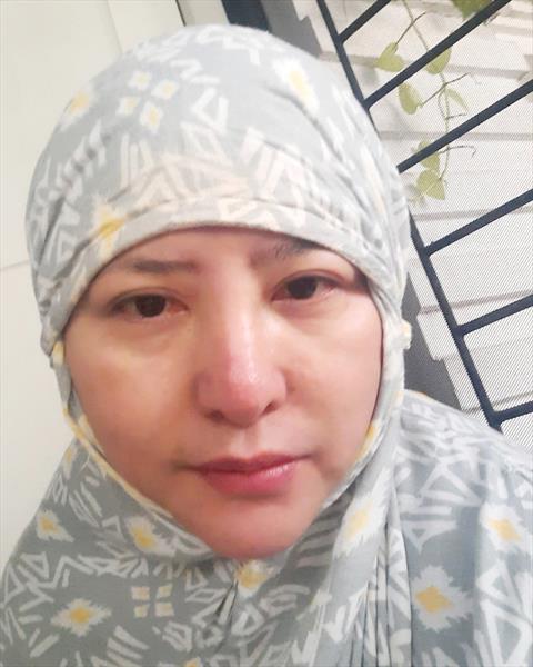 Ana80