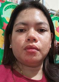 tenaj