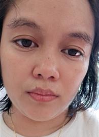 AchEng