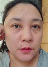lianne24
