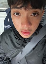 Redxz