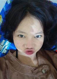 yesidevita