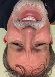 L_H