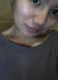GINECUTE