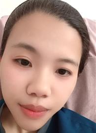 JJONA